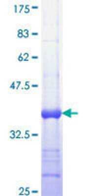 SDS-PAGE: Recombinant Human Smoothened GST (N-Term) Protein [H00006608-Q01]