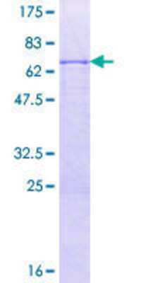 SDS-PAGE: Recombinant Human SNAP45 GST (N-Term) Protein [H00006618-P01]