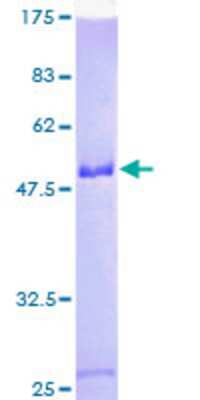 SDS-PAGE: Recombinant Human SNRP70 GST (N-Term) Protein [H00006625-P01]