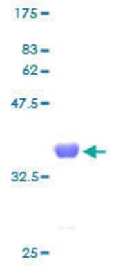 SDS-PAGE: Recombinant Human SNRPE GST (N-Term) Protein [H00006635-P01]