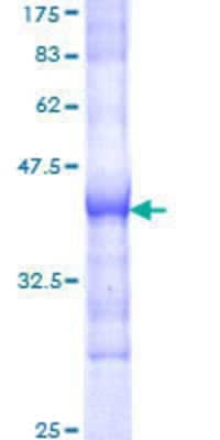 SDS-PAGE: Recombinant Human SOS1 GST (N-Term) Protein [H00006654-Q01]