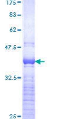 SDS-PAGE: Recombinant Human SOX4 GST (N-Term) Protein [H00006659-Q01]