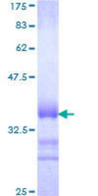 SDS-PAGE: Recombinant Human SOX22 GST (N-Term) Protein [H00006666-Q01]