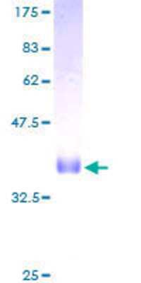 SDS-PAGE: Recombinant Human SPRR1B GST (N-Term) Protein [H00006699-P01]