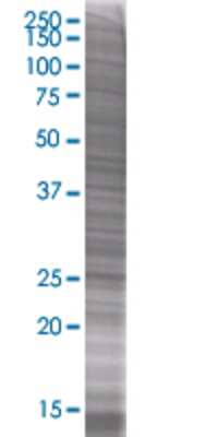 Other: SRD5A1 293T Cell Transient Overexpression Lysate [H00006715-T01]