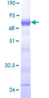 SDS-PAGE: Recombinant Human SSFA2 GST (N-Term) Protein [H00006744-P01]