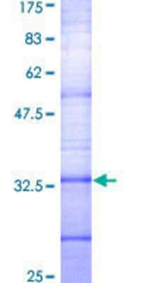 SDS-PAGE: Recombinant Human Somatostatin R2/SSTR2 GST (N-Term) Protein [H00006752-Q01]