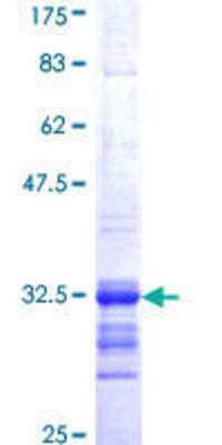 SDS-PAGE: Recombinant Human Somatostatin R2/SSTR2 GST (N-Term) Protein [H00006752-Q02]