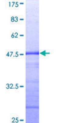 SDS-PAGE: Recombinant Human STAT2 GST (N-Term) Protein [H00006773-Q01]