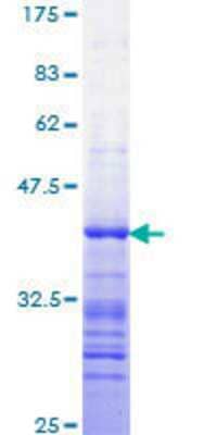 SDS-PAGE: Recombinant Human STAT3 GST (N-Term) Protein [H00006774-Q01]