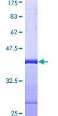 SDS-PAGE: Recombinant Human SUPT5H GST (N-Term) Protein [H00006829-Q01]