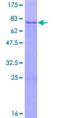 SDS-PAGE: Recombinant Human KMT1A/SUV39H1 GST (N-Term) Protein [H00006839-P01]