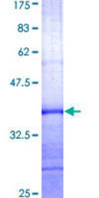 SDS-PAGE: Recombinant Human KMT1A/SUV39H1 GST (N-Term) Protein [H00006839-Q01]