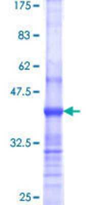 SDS-PAGE: Recombinant Human Supervillin GST (N-Term) Protein [H00006840-Q01]
