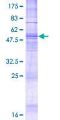 SDS-PAGE: Recombinant Human NK1R GST (N-Term) Protein [H00006869-P01]