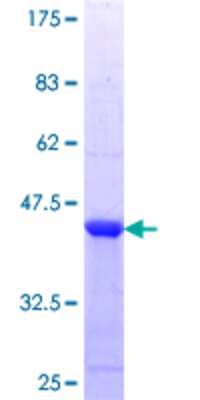 SDS-PAGE: Recombinant Human TAK1 GST (N-Term) Protein [H00006885-Q01]