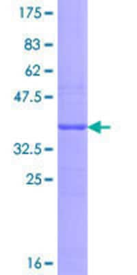 SDS-PAGE: Recombinant Human TAP1 GST (N-Term) Protein [H00006890-Q01]