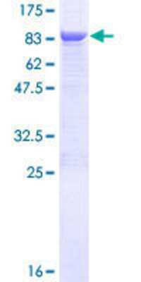 SDS-PAGE: Recombinant Human TBCE GST (N-Term) Protein [H00006905-P01]