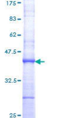 SDS-PAGE: Recombinant Human TATA binding protein TBP GST (N-Term) Protein [H00006908-Q01]