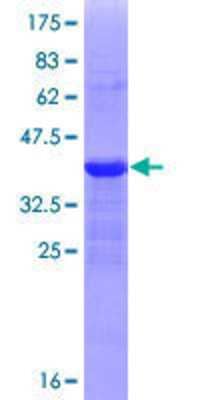 SDS-PAGE: Recombinant Human ZEB1 GST (N-Term) Protein [H00006935-Q01]