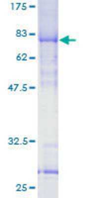 SDS-PAGE: Recombinant Human YL1 GST (N-Term) Protein [H00006944-P01]