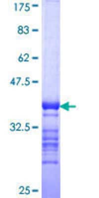 SDS-PAGE: Recombinant Human Thyroglobulin GST (N-Term) Protein [H00007038-Q02]