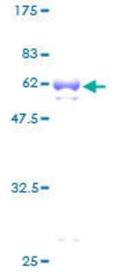 SDS-PAGE: Recombinant Human TGIF1 GST (N-Term) Protein [H00007050-P01]