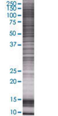 Other: Thrombospondin-4 293T Cell Transient Overexpression Lysate [H00007060-T01]