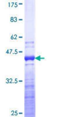 SDS-PAGE: Recombinant Human Troponin T Type 3 (fast skeletal) GST (N-Term) Protein [H00007140-Q01]