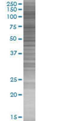 Other: HIRA 293T Cell Transient Overexpression Lysate [H00007290-T01]