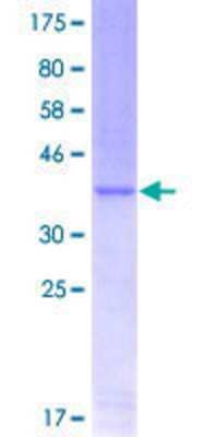 SDS-PAGE: Recombinant Human Twist-1 GST (N-Term) Protein [H00007291-Q01]