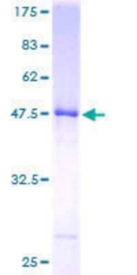 SDS-PAGE: Recombinant Human UBE2E2 GST (N-Term) Protein [H00007325-P01]