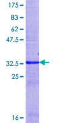 SDS-PAGE: Recombinant Human UGT2B15 GST (N-Term) Protein [H00007366-Q01]