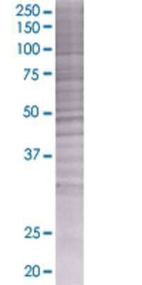 Other: Uromodulin 293T Cell Transient Overexpression Lysate [H00007369-T01]