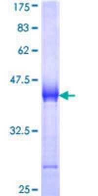 SDS-PAGE: Recombinant Human Utrophin GST (N-Term) Protein [H00007402-Q01]