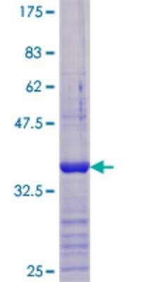 SDS-PAGE: Recombinant Human VDAC1 GST (N-Term) Protein [H00007416-Q03]