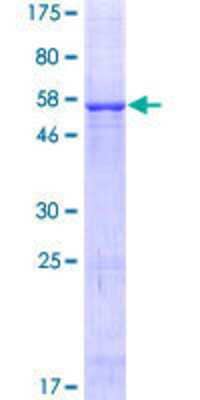 SDS-PAGE: Recombinant Human VDAC3 GST (N-Term) Protein [H00007419-P01]