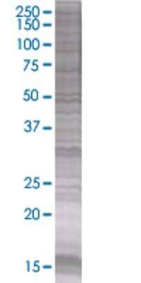 Other: Von Willebrand Factor 293T Cell Transient Overexpression Lysate [H00007450-T01]