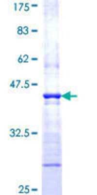 SDS-PAGE: Recombinant Human WASP GST (N-Term) Protein [H00007454-Q01]