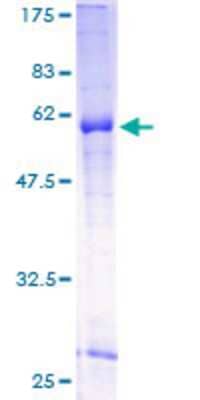 SDS-PAGE: Recombinant Human Wnt-7b GST (N-Term) Protein [H00007477-P01]