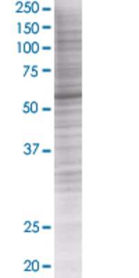 Other: ZSCAN21/ZFP38 293T Cell Transient Overexpression Lysate [H00007589-T01]