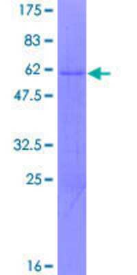 SDS-PAGE: Recombinant Human ZNF124 GST (N-Term) Protein [H00007678-P01]