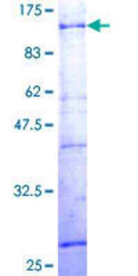 SDS-PAGE: Recombinant Human ZNF133 GST (N-Term) Protein [H00007692-P01]