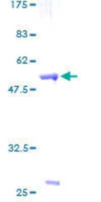 SDS-PAGE: Recombinant Human ZNF174 GST (N-Term) Protein [H00007727-P01]