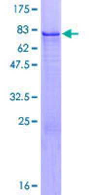 SDS-PAGE: Recombinant Human ZFP200 GST (N-Term) Protein [H00007752-P01]