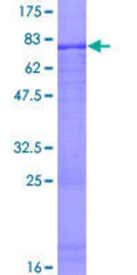 SDS-PAGE: Recombinant Human ZNF223 GST (N-Term) Protein [H00007766-P01]