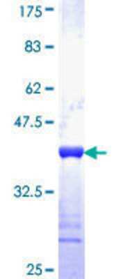 Recombinant Human Slmap Gst (n-term) Protein (h00007871-q01) 