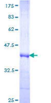 SDS-PAGE: Recombinant Human Frizzled-3 GST (N-Term) Protein [H00007976-Q01]