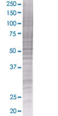 Other: ST8 alpha-2,8-Sialyltransferase 8B/ST8SIA2 293T Cell Transient Overexpression Lysate [H00008128-T01]