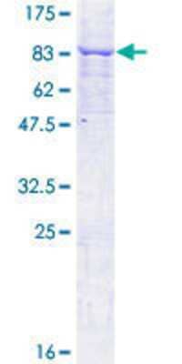 SDS-PAGE: Recombinant Human MKKS GST (N-Term) Protein [H00008195-P01]